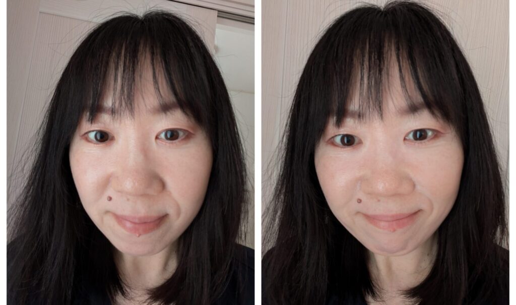 ビフォーアフター写真
